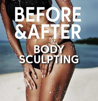 body-sculpting-liposuction-before-after